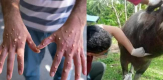 Bacolod City Vice Mayor El Cid Familiaran, nagpanawagan sa paghalong kasunod sang mga kaso sang Monkey Pox sa Iloilo kag Glanders disease sa Siquijor