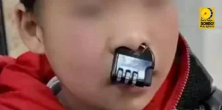 Padlock, katingalahan kun paano natakod sang isa ka bata sa iya ilong