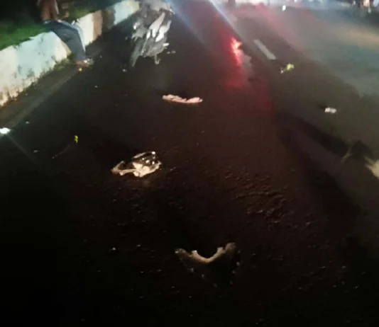 6 ka soltero, pilason matapos maaksidente ang duha ka motorsiklo sa Araneta Street, Brgy Tangub, Bacolod City