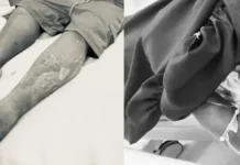 Sigud a barangay kapitan ken ti kadwana, maag-agasan iti ospital kalpasan a napalpaltogan dagitoy idiay Abra