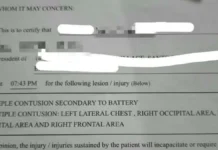 Anim na estudyante, na-expel matapos masangkot sa umano’y bullying sa Melvin Jones, Baguio City