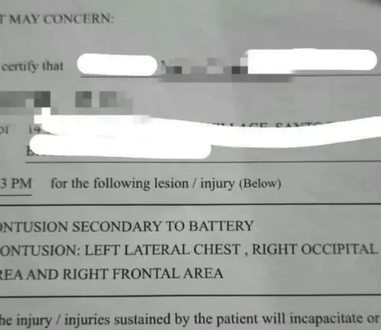 Anim na estudyante, na-expel matapos masangkot sa umano’y bullying sa Melvin Jones, Baguio City