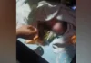 Bag-ong natawong bata nga gibutang sa tangkal sa baboy, anaa na sa luwas nga kahimtang