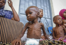 MSF Nagpasidaan sa Nagkagrabeng Malnutrisyon sa mga Bata sa Southwestern Somalia