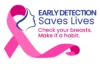 Huling pagpapakonsulta sa breast cancer sa bansa, ibinalala ng isang eksperto