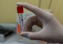 Test kit sa molecular laboratory sa Dr. Jorge P. Royeca Hospital gikulang