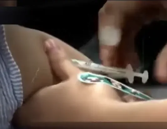CHO-Gensan, giklaro nga temporaryo lamang ang kasagarang reaksyon sa bakuna sa mga bata