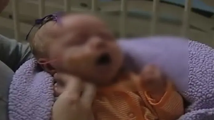 PERTUSSIS PATIENT