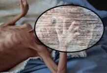 Mga nagamasakit bangud sa indi safe nga pagkaon adlaw-adlaw,yara sa 1.6 milyon suno sa WHO
