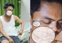 Rider,diutayan lang mautdan sang liog matapos nagsab-it sa nagalaylay nga kable