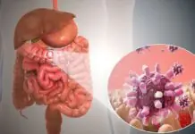 Napatay bangud sa gastroenteritis sa Iloilo City, naglab-ot na sa 10; higko nga bubon, posible pugaran sang coliform bacteria
