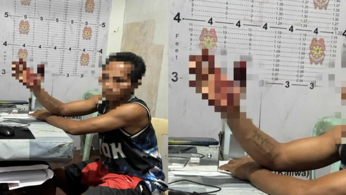 Stabbing incident in Calinog, Iloilo