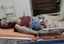 Driver sang motorsiklo, patay matapos nga nakabunggo sa awto sa Brgy. Sigangao, Zarraga, Iloilo