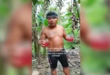 Iloilo vlogger sets himself on fire after drinking gasoline, suffers severe burns