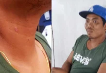 Liog sang suspek nga nagpatay sa dalaga sa Tubungan, may mga agi sang kinarusan nga patimaan sang pagbato sang biktima