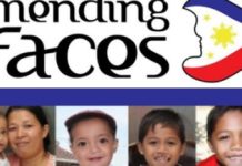Libreng operasyon para sa sungi ag ngongo sa Aklan, pagahiwaton