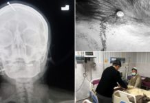 Nabdos nga ginang sa Pakistan, nagpabutang it eansang sa ueo agud nga makasigurado nga magiging eaeaki ro anang gina nabdos