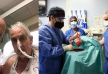 Kauna-unagan nga tawo sa kalibutan nga nakabaton it heart transplant gamit ro tagipusuon it baboy, namatay eon