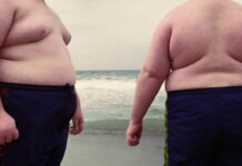 Mga tawong overweight ag obese, maabu nga mga sakit ro pwedeng maangkon