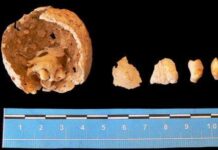 1.8 million year old nga “human tooth”, nadiskubre it archeologist sa Georgia