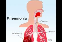 Pulmonya