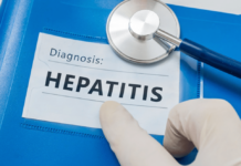 Hepatitis, sangka baeatian nga nagatuga it inflammation it atay