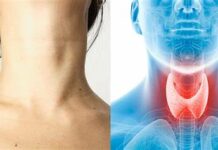 10 mga senyales nga ikaw hay naga angkon it thyroid problem