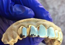 Eaeaki, aksidenteng natueon ro ‘grillz’ sa ngipon, ag bumara sa anang lungs!