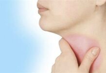 Ano ro strep throat?