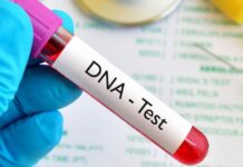 “Kon sin-o ro nagaeagas imaw ro maggastos sa DNA test” direktang sabat ni Yabut sa alegasyon kontra kana