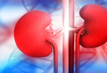 Numero it mga Pinoy nga may chronic kidney disease ukon CKD, masobra sa pitong milyon eon