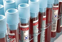 Kaso ng HIV sa mga kabataan, inaasahang tataas pa pagdating ng 2030 – Aids society of the Philippines