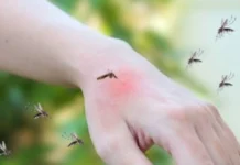 Kaso ti dengue iti Pilipinas, umaboten iti nasurok a 205 ribo, segun iti Department of Health