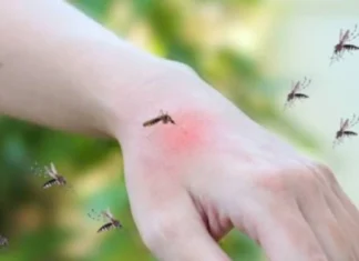 Kaso ti dengue iti Pilipinas, umaboten iti nasurok a 205 ribo, segun iti Department of Health