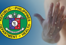 Face mask, saan nga epektibo kontra mpox — DOH