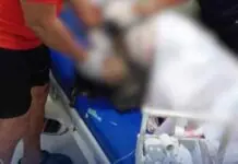 Parasisira, gadan makalihis tamaan nin kikilat sa Sorsogon Mangingisda tinamaan ng kidlat