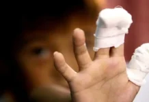 Firecracker related injuries sa Bicol, pumalo pa sa siyam na kaso ilang araw bago ang pagsalubong sa bagong taon FIRECRACKER RELATED INJURY
