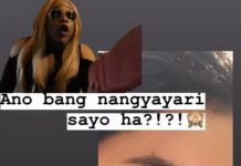 Angel Locsin, nakagat ng aso sa mukha Angel Locsin 2
