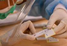 DOH: ‘Negative results ng antigen test kailangan makumpirma ng RT-PCR test’ antigen test japan