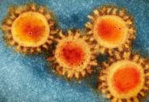 3 bagong kaso ng SARS-CoV-2 mutations, naitala sa Central Visayas – DOH SARS CoV 2 virus COVID 19
