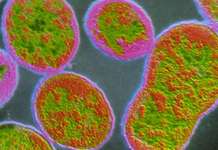 DOH nakabantay vs banta ng bacterial disease na ‘brucellosis;’ 6,000 katao nag-positibo sa China Brucellosis
