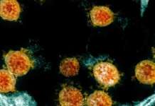 South African variant cases nadagdagan ng 52, UK variant may dagdag na 31: DOH SARS CoV 2 US NIH NIAID