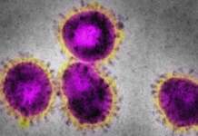 PH COVID-19 cases pumalo pa sa 582,000; total deaths 12,000 SARS CoV 2
