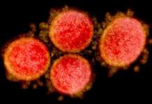 PH COVID-19 active cases halos 139K; pinakamataas sa Southeast Asia SARS COV 2 2