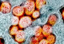 Mga kaso ng ‘mas nakakahawang’ COVID-19 variants sa PH, nadagdagan pa: DOH SARS CoV 2 virus 1