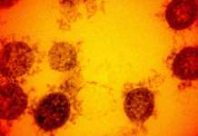 ‘P.3 variant,’ hindi kasing-bagsik ng COVID-19 variants of concern: DOH SARS CoV 2 virus NatGeo