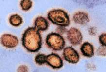 ‘Record high’: PH new COVID-19 cases umabot ng 3,045; total lumobo pa sa 587K – DOH SARS CoV 2 virus WBFO