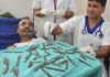 40 ka kutsilyo, nakuha sa tiyan sang isa ka lalaki