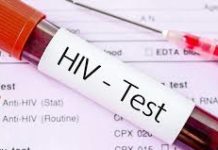 Isang lalaki sa Kalinga,nagpositibo sa HIV